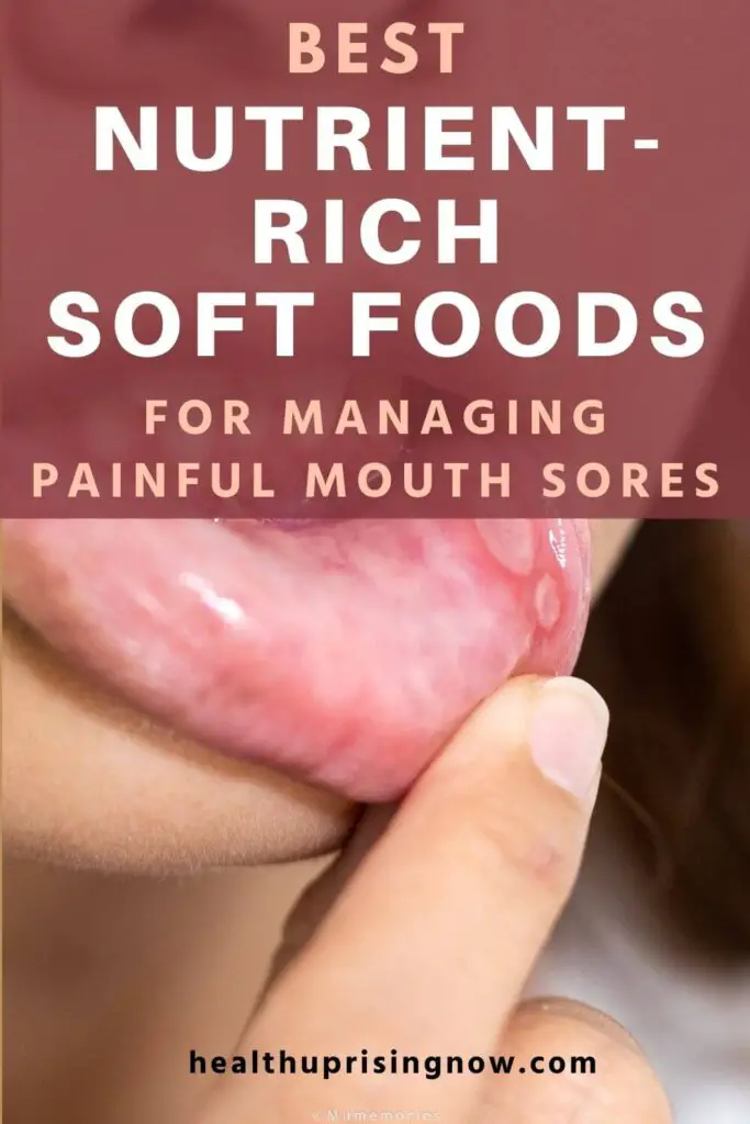 best foods for sore mouth